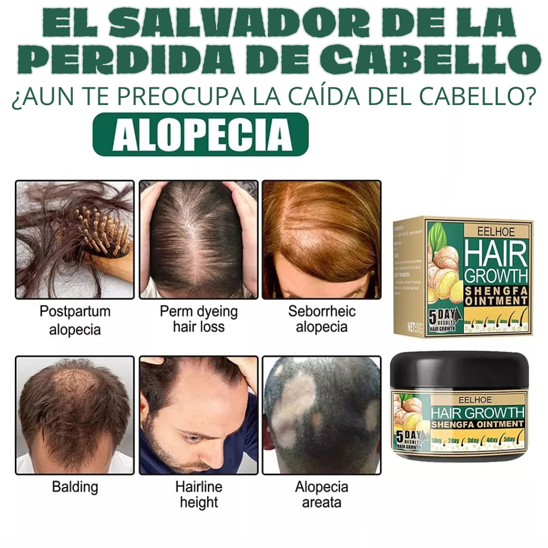 2X1 GingerGrow® Crecimiento Capilar Natural con Jengibre 💫💇♂️