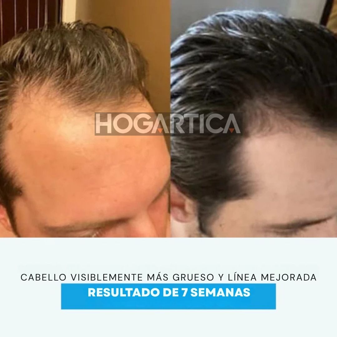 Hair-Fuse Pro™ Cepillo Renovador Capilar