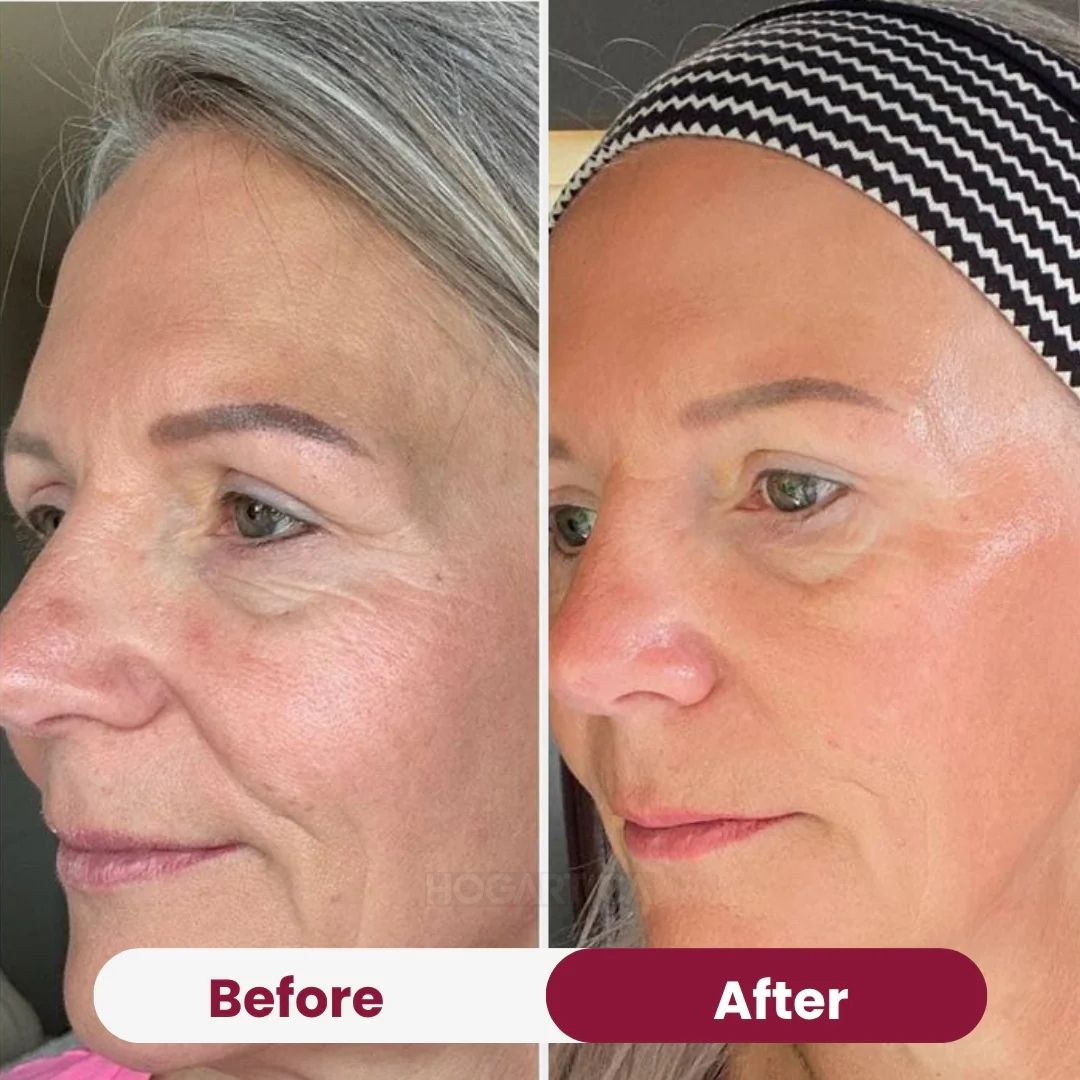 Glowéa™ Mascarilla de Biocolágeno| Cuidado de la piel premium, sin salir de casa