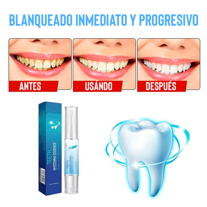 SnowDenty™ Blanquea tu sonrisa en minutos, sin dolor ni sensibilidad