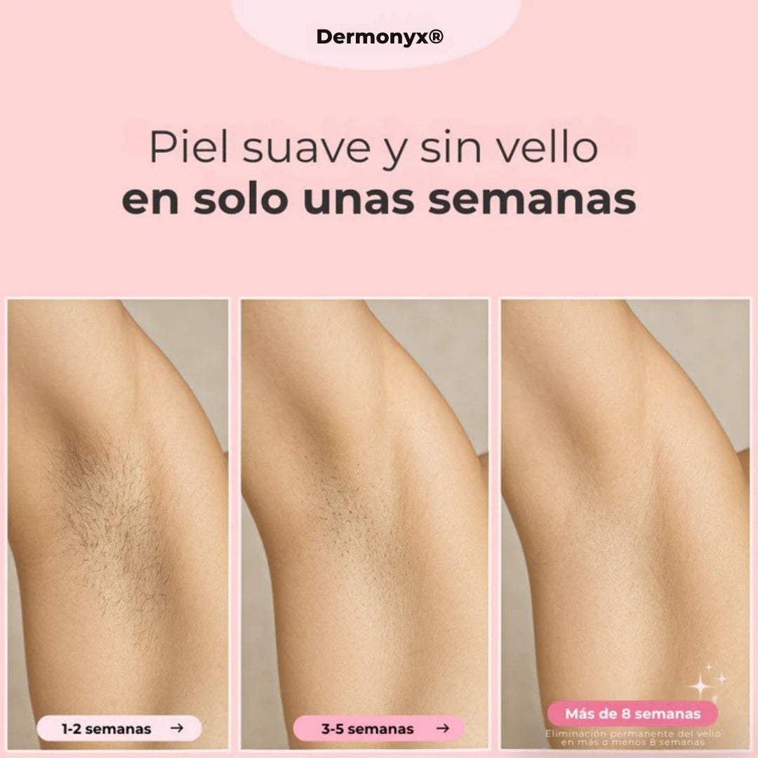 Dermonyx® – Depiladora Láser Indolora con Tecnología IPL + OBSEQUIO GRATIS
