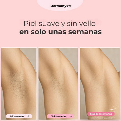 Dermonyx® – Depiladora Láser Indolora con Tecnología IPL + OBSEQUIO GRATIS
