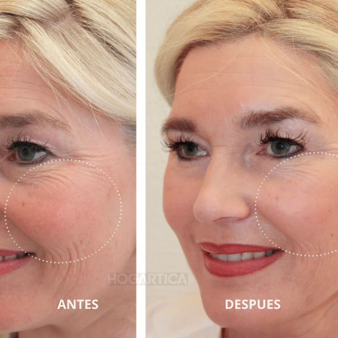 ReLisse™ | Cinta de silicona contra cicatrices y arrugas