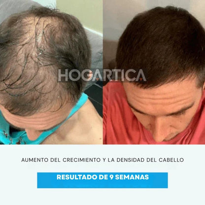 Hair-Fuse Pro™ Cepillo Renovador Capilar