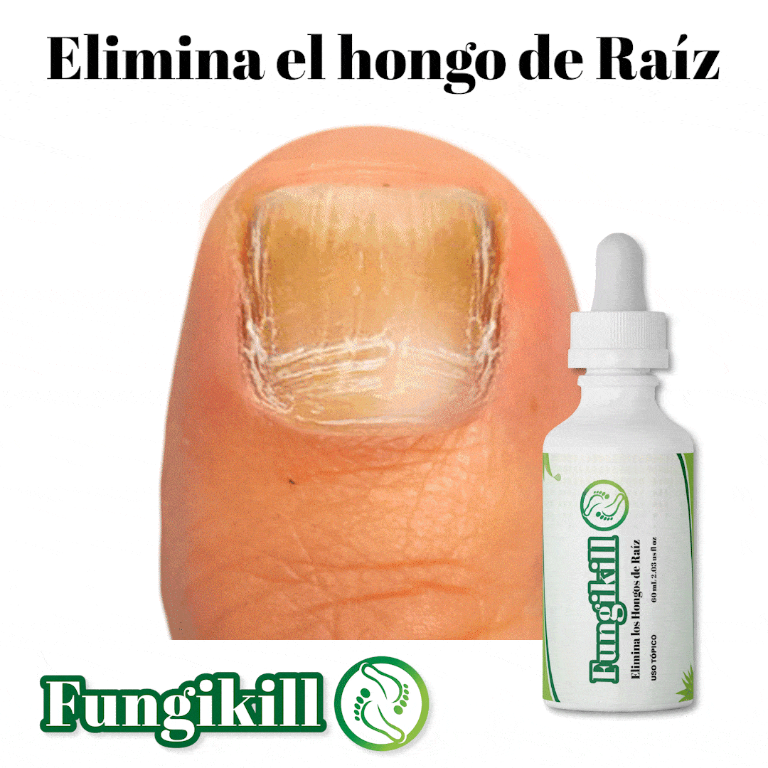 FUNGIKILL® X2 Despídete del hongo en tus uñas sin dolor