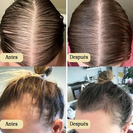 Veganic™  ¡Despierta la Vitalidad Natural de tu Cabello!  🌿